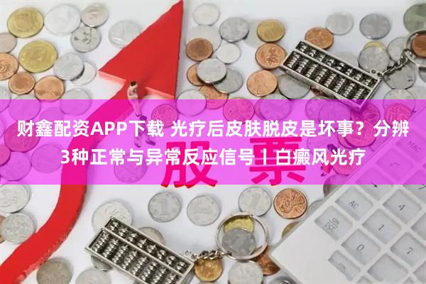 财鑫配资APP下载 光疗后皮肤脱皮是坏事？分辨3种正常与异常反应信号丨白癜风光疗